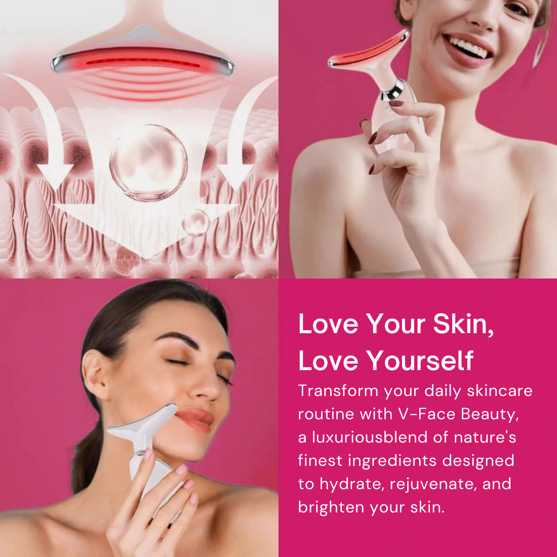 Intense Pulsed Light®